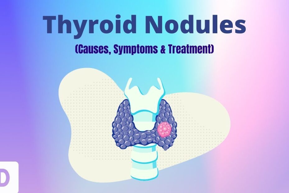 Thyroid nodules symptoms