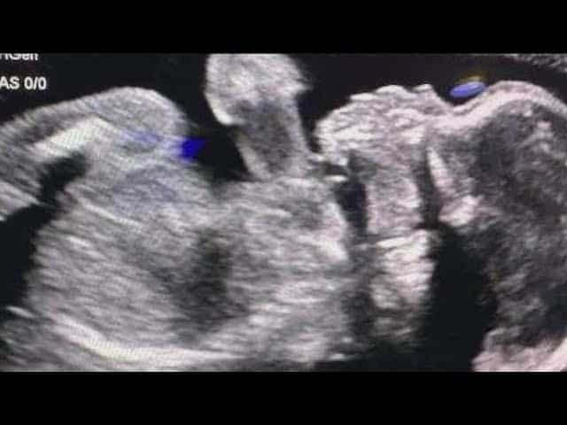 Adriana Smith Baby Born