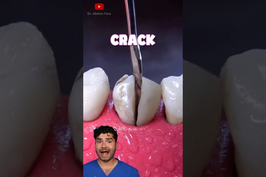 Canine Tooth Dan Word